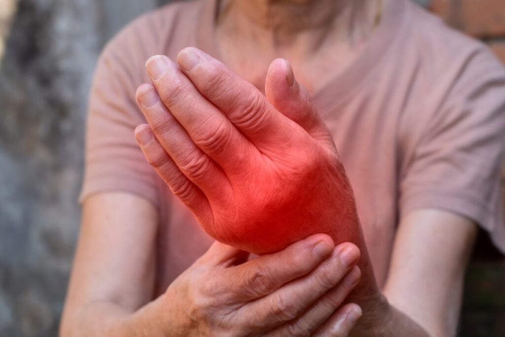 Early Warning Signs of LUPUS You Need to Know (AND WHAT TO WHEN You THEM!)